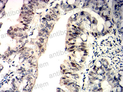 Валидация AntibodySystem RHD34804