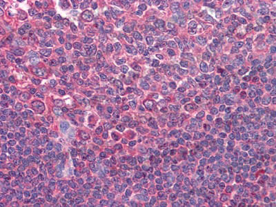 Валидация AntibodySystem RHE03402