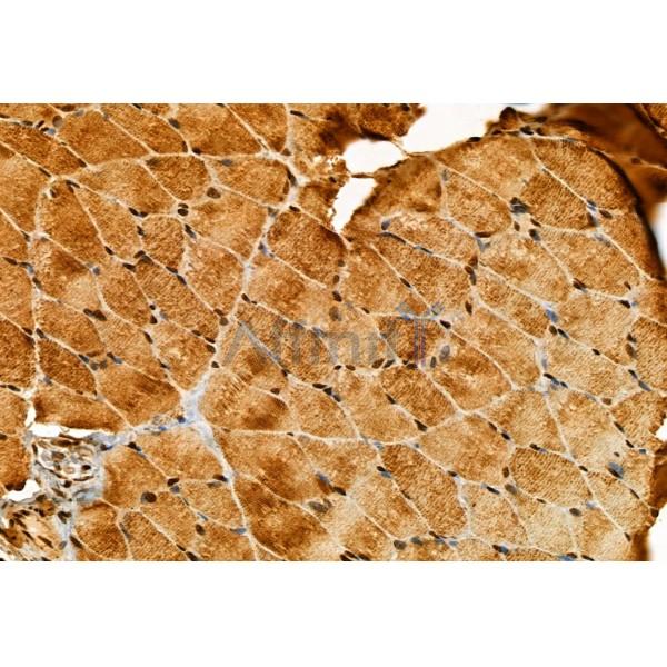 Валидация Affinity DF12087 - 6185