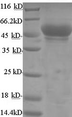 SDS-PAGE