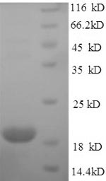 SDS-PAGE