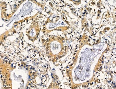 Валидация Affinity DF13838 - 9535