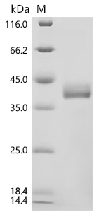 SDS-PAGE