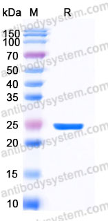 EHA49701, SDS-PAGE