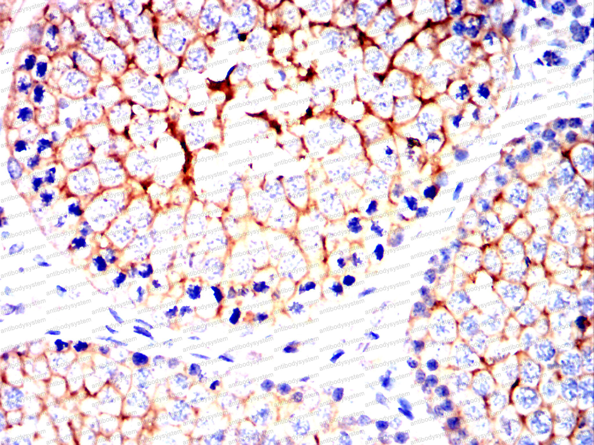 Валидация AntibodySystem RHD46601 (1592)