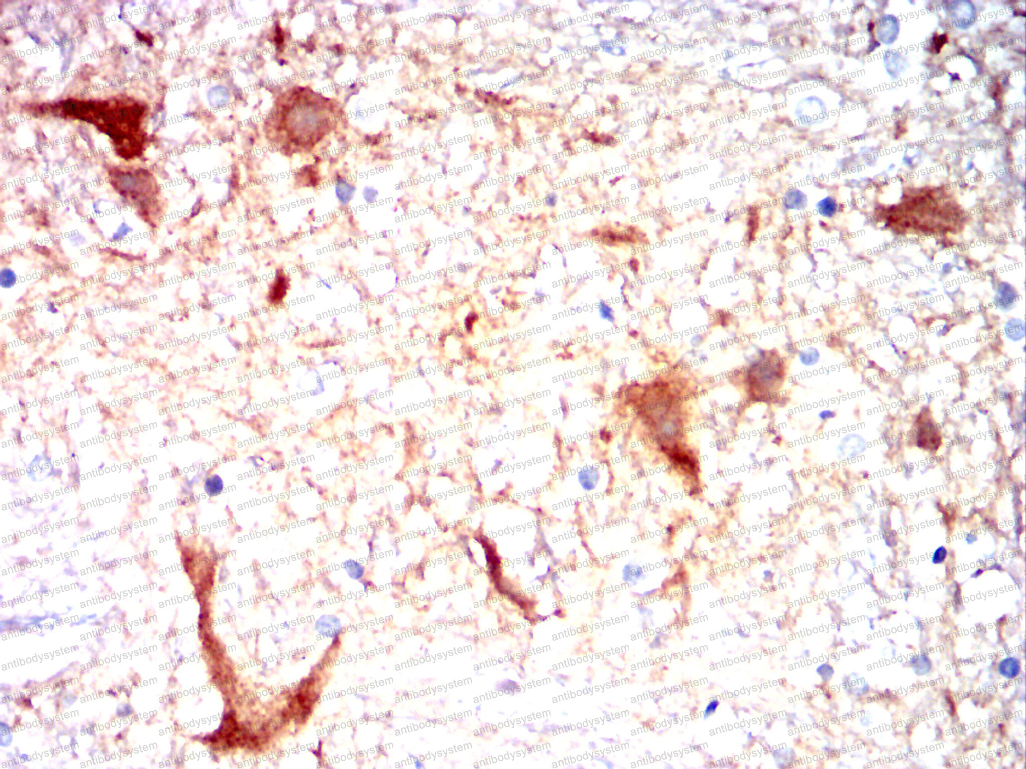 Валидация AntibodySystem RHG58404