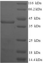SDS-PAGE