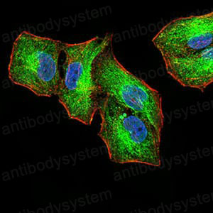 Валидация IF - AntibodySystem RHJ91202