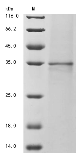 SDS-PAGE