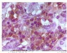 Валидация AntibodySystem RHJ52503