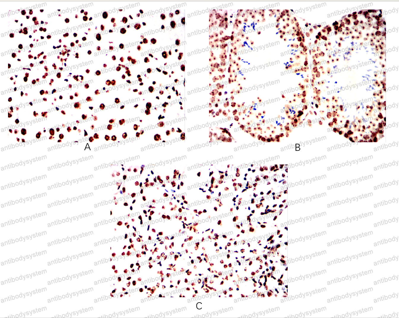 Валидация AntibodySystem RHE37704 (2125)