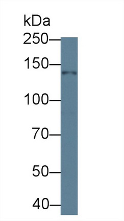 14157