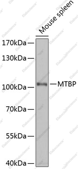 Вестерн-блоттинг, MTBP, ткань селезенки мыши