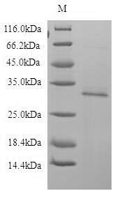 SDS-PAGE