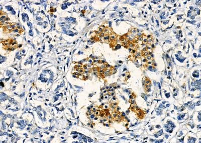 Валидация Affinity DF8687 - 20663