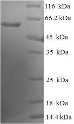 SDS-PAGE