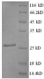 SDS-PAGE