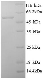 SDS-PAGE