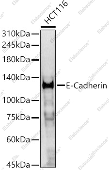 Вестерн-блоттинг, E-Cadherin, клетки HCT116