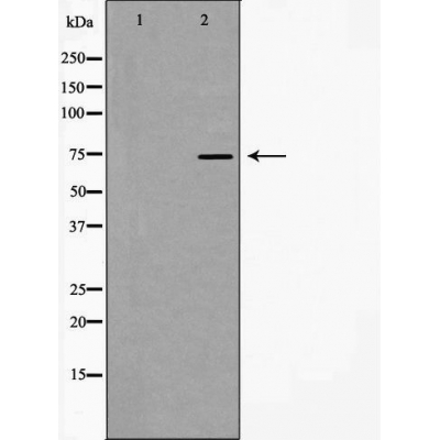 Валидация Affinity AF5276 - 2801