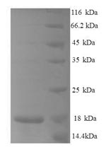 SDS-PAGE