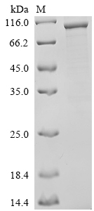 SDS-PAGE