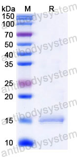 Валидация SDS-PAGE - AntibodySystem RHD17201