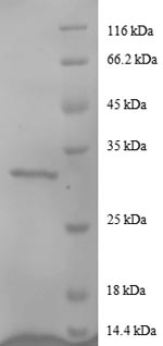 SDS-PAGE