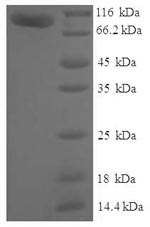 SDS-PAGE