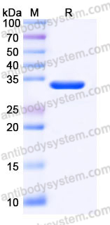 YHK42802, SDS-PAGE