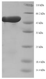 SDS-PAGE