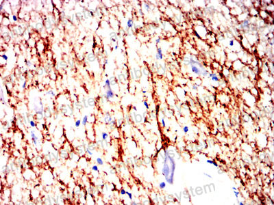 Валидация AntibodySystem RHF56704 (2568)