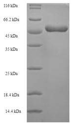 SDS-PAGE