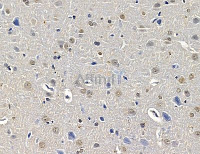 Валидация Affinity DF14898 - 11054