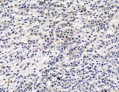 Валидация Affinity DF15549 - 11951