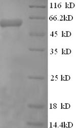 SDS-PAGE