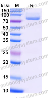 AHJ41005, SDS-PAGE