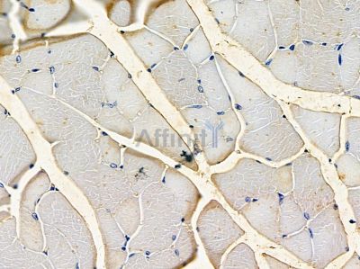 Валидация Affinity DF13256 - 8331