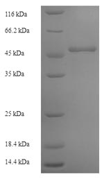 SDS-PAGE