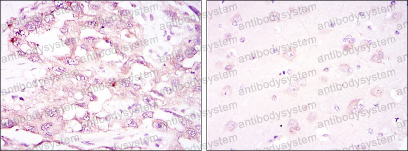 Валидация AntibodySystem RHG41603
