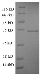 SDS-PAGE