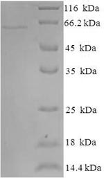 SDS-PAGE