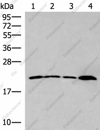Вестерн-блоттинг, IFNA5, клетки MDA-MB-231, клетки Raji, ткань печени плода человека