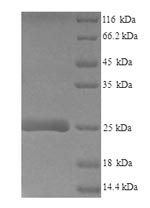 SDS-PAGE