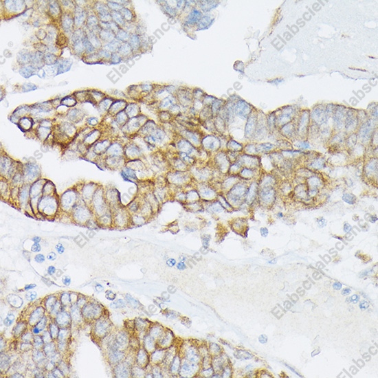 Иммуногистохимия, MRP4/ABCC4, ткань оофоромы человека