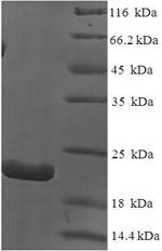 SDS-PAGE
