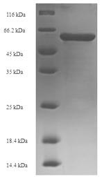 SDS-PAGE
