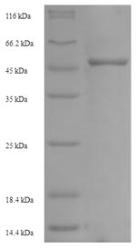 SDS-PAGE
