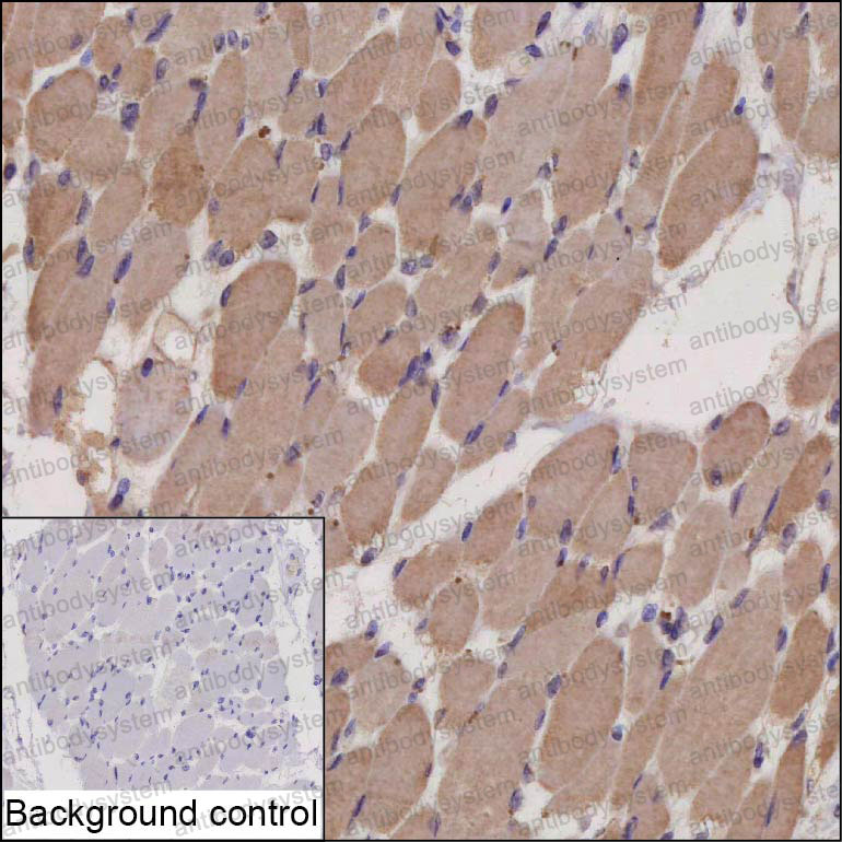 Валидация AntibodySystem RHF12301