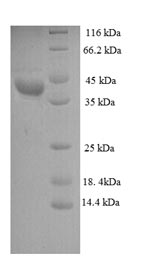 SDS-PAGE